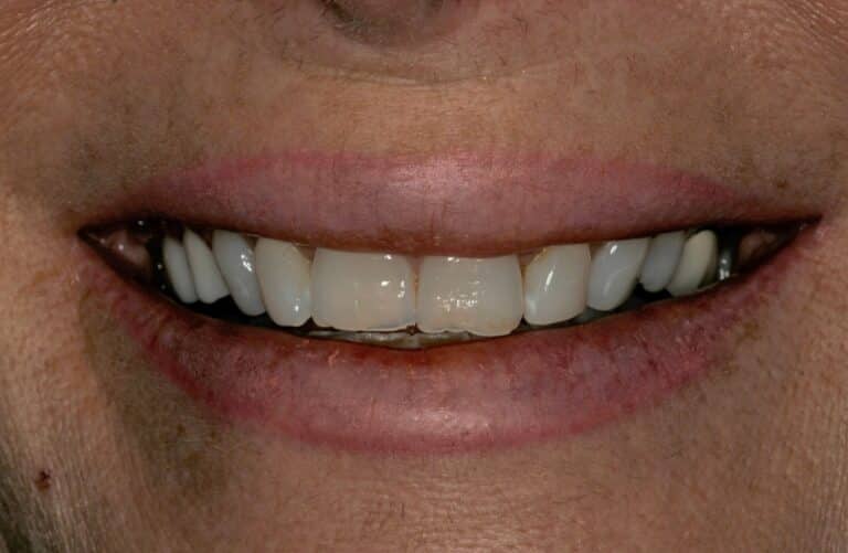 Konig Center for Cosmetic & Comprehensive Dentistry smile photos